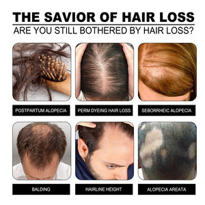 EELHOE-Barra de champú de jengibre para el crecimiento del cabello, jabón calmante para el cuero cabelludo, pérdida de rotura, prevención, barra de champú sólida para el cabello - Product Image 4