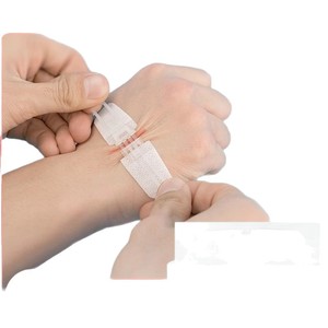 Dispositivo de sutura para heridas cutáneas Beijiashu, vendaje elástico tipo cremallera para reducción de cicatrices y cuidado de heridas - Product Image 1
