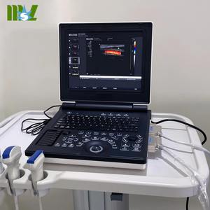 पोर्टेबल रंग डॉपलर 3 डी 4 डी अल्ट्रासाउंड मशीन पूर्ण डिजिटल अल्ट्रासोनिक डायग्नोस्टिक इमेजिंग सिस्टम पोर्टेबल अल्ट्रासाउंड मशीन - Product Image 1