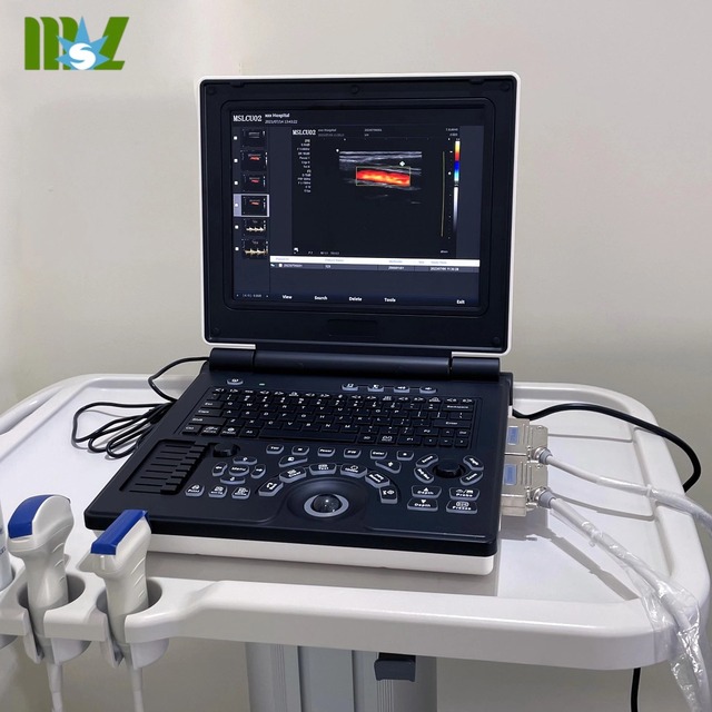 Portable Color Doppler 3D 4D  Ultrasound Machine Full Digital Ultrasonic Diagnostic Imaging System Portable Ultrasound Machine