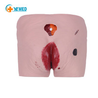 Modelo de Enseñanza de Ciencias Médicas para Úlceras por Decúbito, Modelo de Entrenamiento Médico, Maniquí de Enfermería para el Cuidado de Heridas por Decúbito, CE/ISO