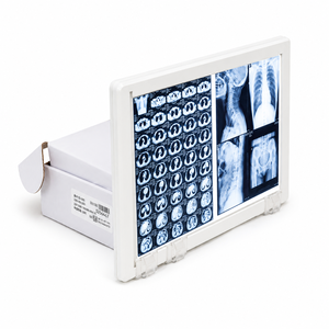 Negatoscopio LED <span class=keywords><strong>de</strong></span> doble panel <span class=keywords><strong>de</strong></span> alto rendimiento para visualización <span class=keywords><strong>de</strong></span> rayos X, visualizador <span class=keywords><strong>de</strong></span> películas <span class=keywords><strong>de</strong></span> rayos X LED médico, <span class=keywords><strong>caja</strong></span> <span class=keywords><strong>de</strong></span> visualización <span class=keywords><strong>de</strong></span> imágenes. - Product Image 1