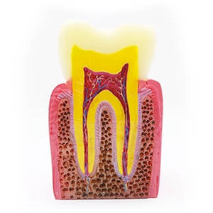Estudio directo de fábrica <span class=keywords><strong>dentista</strong></span> anatómico oral cariado diente común enfermedades dentales modelo de comparación - Product Image 3