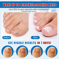 Vente en Gros Marque Blanche Traitement Mycoses Ongles Force Maximale Solution Anti-Fongique Réparation Ongles Sérum Mycoses Ongles Pieds