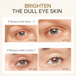 Suero Reafirmante para el Contorno de Ojos LAIKOU, Elimina Arrugas, Ojeras e Hinchazón, con Vitamina E y Oro de 24K, Antienvejecimiento - Product Image 3