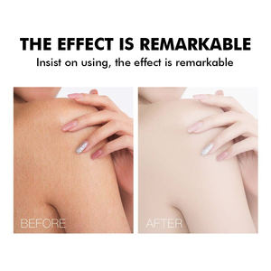 <span class=keywords><strong>La</strong></span> <span class=keywords><strong>mejor</strong></span> loción <span class=keywords><strong>para</strong></span> aclarar el cuerpo a base de hierbas, <span class=keywords><strong>crema</strong></span> de Ácido Kójico enriquecido con glicerina, Lociones corporales blanqueadoras <span class=keywords><strong>para</strong></span> adultos con <span class=keywords><strong>piel</strong></span> negra - Product Image 3