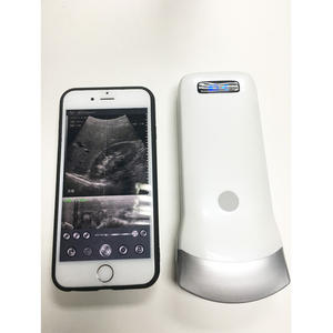 Mesin <span class=keywords><strong>Ultrasound</strong></span> Nirkabel Portabel Multi-Sistem SonoStar - Product Image 2