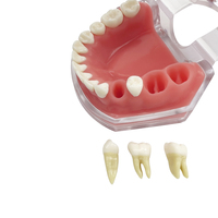 Modèle dentaire en résine YOUYA DENTAL TM-098 avec dents amovibles pour la pratique de l'extraction et l'éducation des patients