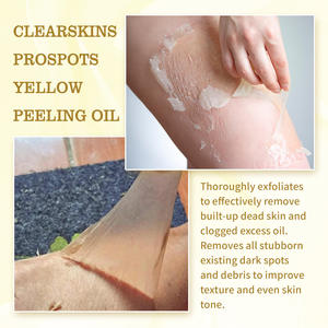 OEM/ODM Peeling Oil Cuerpo Piel Piernas Blanqueamiento facial Aceite de cáscara orgánico natural Exfoliante Extra fuerte Líquido amarillo - Product Image 4