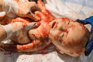 Simulador Médico de Silicona de Alta Gama <span class=keywords><strong>Mia</strong></span> de POYTON MEDVISION - Product Image 6