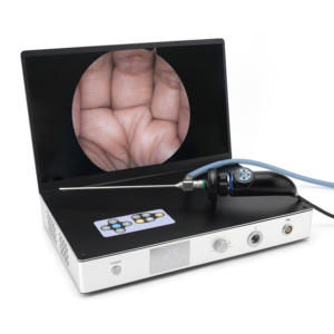 Full HD endoskop kamera 15.6 inç 4 in 1 tıbbi endoskop ekipman sistemi 1080P hepsi bir cerrahi endoskop kamera taşınabilir - Product Image 2