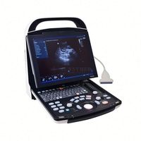Sistema de Diagnóstico por Imágenes y Ecógrafo Mindray DP-30 Totalmente Digital con Carro