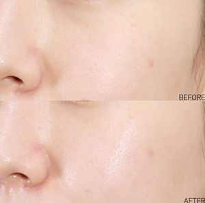 Crema Coreana SOS Skin Solution con 71% de <span class=keywords><strong>Aloe</strong></span> <span class=keywords><strong>Vera</strong></span> y Centella Asiática, Humectante Calmante para Piel Sensible, Alivio del Enrojecimiento, 80g - Product Image 6