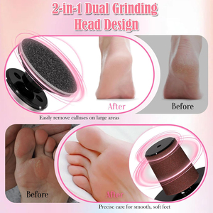 Lima Eléctrica Recargable para Pies, Lima de Uñas, Herramienta de Pedicura Inalámbrica a Prueba de Agua, Removedor de Callosidades para Eliminar Piel Muerta - Product Image 2