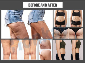 Máquina de Presoterapia de 24 Cavidades para Drenaje Linfático y Adelgazamiento, Uso Profesional en Salones de Belleza, Gran Venta - Product Image 4