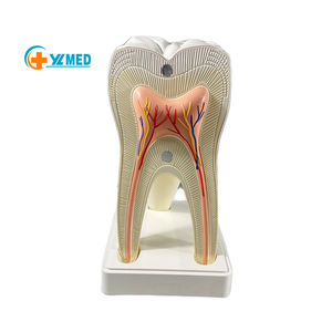 Modelo de Anatomía Humana Ampliado para Enseñanza de Biología y Ciencias Médicas, Modelo de Dientes Molares de 2 Partes con Decadencia Dental - Product Image 1