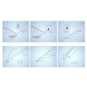 Ferramenta cirúrgica médica descartável, <span class=keywords><strong>stapler</strong></span> da pele do ponto <span class=keywords><strong>35w</strong></span> 55w e manchas cirúrgicas com removedor 15w 25w <span class=keywords><strong>35w</strong></span> - Product Image 2