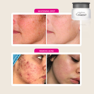 La <span class=keywords><strong>mejor</strong></span> <span class=keywords><strong>crema</strong></span> facial de colágeno de caracol para blanquear la piel clara, <span class=keywords><strong>crema</strong></span> facial de belleza para hombres y mujeres, piel brillante en Arabia Saudita, cuidado Facial - Product Image 5