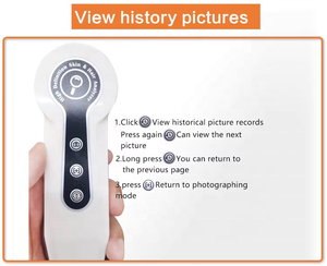 เครื่องวิเคราะห์รูขุมขนและหนังศีรษะ HD 2025เครื่องวิเคราะห์เส้นผมเครื่องวิเคราะห์หนังศีรษะสำหรับสปาผม - Product Image 4