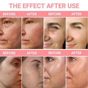 Bộ Sản Phẩm Làm Trắng Và Dưỡng Ẩm OEM/ODM Sữa Dưỡng Thể Cà Rốt Dầu Cơ Thể Tẩy Tế Bào Chết Dâu Tây Làm Sáng Xà Phòng Làm Đẹp - Product Image 6