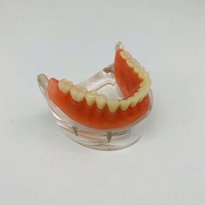 KyrenMed-Localisateur dentaire à quatre implants, modèle de prothèse inférieure, dents amovibles, modèle <span class=keywords><strong>mandibulaire</strong></span> - Product Image 5