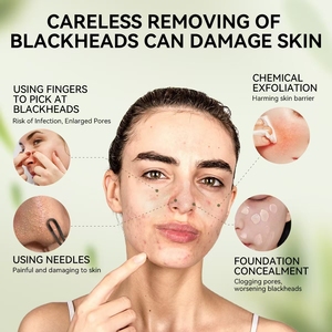<span class=keywords><strong>LANBENA</strong></span> Nueva Mascarilla Facial para Eliminar Puntos Negros, Tiras Adhesivas para Limpiar Poros de la Nariz, Mascarilla Nasal J1 - Product Image 6