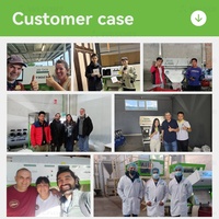 Clasificador de Formas y Colores por IA de Aprendizaje Profundo 6SXZ-68L para Nueces y Avellanas con >99.99% de Precisión, Maquinaria de Procesamiento de Alimentos con Certificación CE/FCC