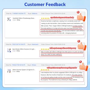 Láser LED Excimer UVB Portátil de 308 nm para Vitiligo, Psoriasis, Dermatitis Atópica, Eccema, Dermatitis Seborreica en Venta - Product Image 4