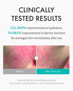 Ampoule éclaircissante intensive Rejuran White, sérum anti-taches, acide tranexamique, booster éclaircissant pour unifier le teint - Product Image 3