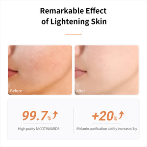 Suero Facial Corrector de Manchas Oscuras con Vitamina C y Ácido Hialurónico, con Extracto de Té Verde - Fórmula Líquida - Product Image 5