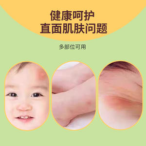 Gel médical pour la peau Sunflower 20g, médicamenteux, pour le soin de la peau des bébés, soulagement de la dermatite, de l'acné et de l'eczéma - Product Image 5