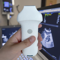 Escáner de Ultrasonido Doppler Inalámbrico Lineal Portátil Veterinario Eléctrico de 64 Canales, 192E, 16Mhz, 20Mhz