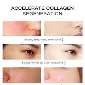 Bağımsız hammadde araştırma geliştirme sonsuza cilt Aha beyazlatma özü yüz kremi - Product Image 3