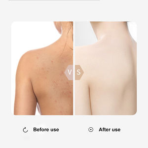 Soin de la peau au <span class=keywords><strong>caramel</strong></span> personnalisé lotion pour le corps Easy Glow hydratant et réparateur pour peau noire blanchissant et éclaircissant - Product Image 6