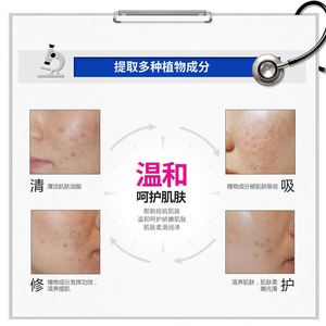 เจลล้างสิวสำหรับครีมกำจัดสิว Bioaqua benzoyl peroxide - Product Image 4