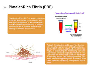 MANSON medico ricco di fibrina piastrinica U-PRF tubo da 22ml per odontoiatria - Product Image 4