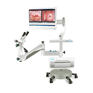 डिजिटल HD इंडोस्कोपिक कैमरा colposcope योनि लचीला योनि <span class=keywords><strong>endoscope</strong></span> उच्च अंत ऑप्टिकल colposcope - Product Image 1