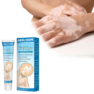 Pommade réparatrice cutanée localisée d'usine OEM pour le traitement des taches blanches, du vitiligo, du <span class=keywords><strong>psoriasis</strong></span> et de la leucoplasie – Fourniture de santé - Product Image 1