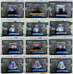 Ecógrafo Médico a Color para Embarazo, Tipo Carrito, Ultrasonido <span class=keywords><strong>Doppler</strong></span> 3D 4D - Product Image 2