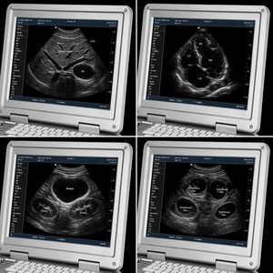Ecógrafo Veterinario Portátil en Blanco y Negro, Escáner de Ultrasonido Veterinario Tipo <span class=keywords><strong>Laptop</strong></span> <span class=keywords><strong>para</strong></span> Perros y Gatos - Product Image 2