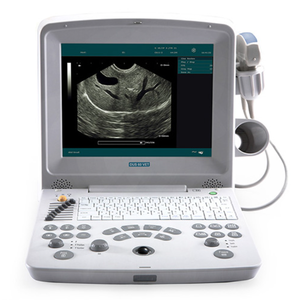 Máquina de Ultrasonido Veterinaria Portátil Edan DUS 60 con Batería Integrada y Certificación CE para Diagnóstico Animal - Product Image 1