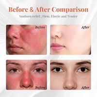 Masque facial à l'ectoïne, réparation après-soleil, hydratation, soulagement des coups de soleil, masque apaisant hydratant pour après une procédure esthétique en salon