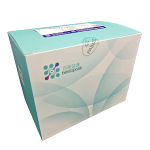 고수율 플라스미드 추출 키트 (50T) 트랜스펙션용 - Product Image 6