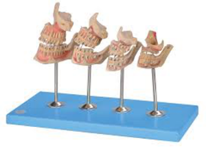 Modèle de mannequin de développement dentaire Chinon BIX-B10006, dents et mâchoires, éruption dentaire temporaire et permanente, pour l'anatomie en faculté de médecine - Product Image 2