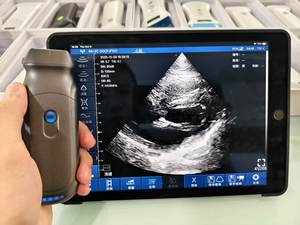 مسبار ملون لاسلكي محمول باليد ، مسبار جيب على شكل قلب صفيف مراحل لاسلكي - Product Image 4