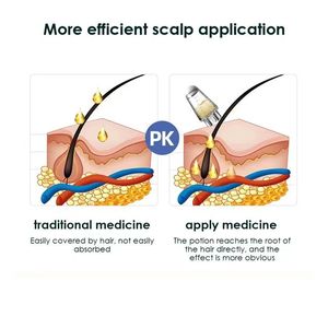 Masajeador de Cuero Cabelludo de Plástico con Vibración, Peine de Masaje para el Tratamiento del Crecimiento del Cabello, Aplicador de Aceite Capilar, Dispensador de Suero de Aceites Esenciales - Product Image 2