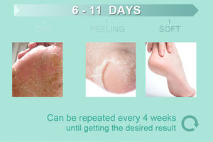 2024 Nuevos productos OEM Tipo de suministro Peeling Off Beauty Foot Mask para el cuidado personal - Product Image 4