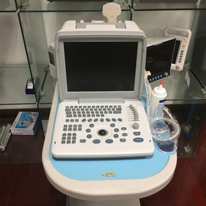 Sonda <span class=keywords><strong>Doppler</strong></span> <span class=keywords><strong>Abdominal</strong></span> Eléctrica para Embarazo, Sistema de Ultrasonido Obstétrico Portátil, Ultrasonido <span class=keywords><strong>Abdominal</strong></span> - Product Image 2