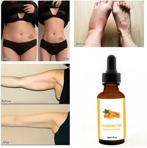 Huile de gingembre pure naturelle chauffante pour massage corporel, amincissante thérapeutique, brûle-graisse, favorisant la croissance des cheveux, soulagement de la douleur, marque privée OEM - Product Image 3