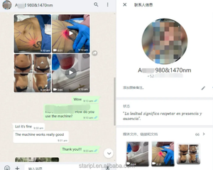 Endoláser de Doble Onda 980nm 1470nm para Dermatología, Eliminación de Venas Vasculares, Cirugía Plástica, Lifting Facial y Rejuvenecimiento de la Piel - Product Image 2